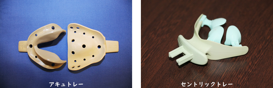 BPS 概形印象採得