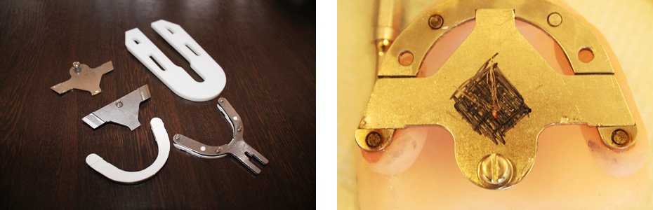 BPS ゴシックアーチ描記