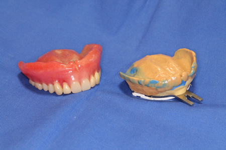 BPS オーダーメードで作成したトレー