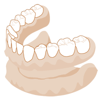 精密入れ歯・義歯