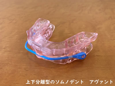 上下分離型のソムノデント　アヴァント