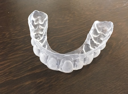 ホワイトニング